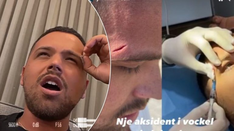 “Një aksident i vogël nga një lojë…”/ Ylli Limani përfundon në spital collage 7 780x439 1 770x433 1