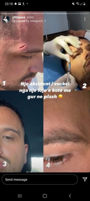 ylli2
