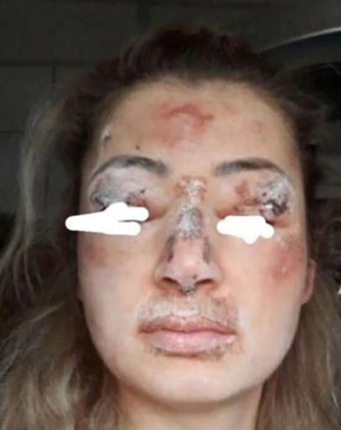 Arrestohet kirurgia e rreme kozmetike që gjymtoi 11 pacientë, duke i lënë me shenja të tmerrshme (fotot) 3 4