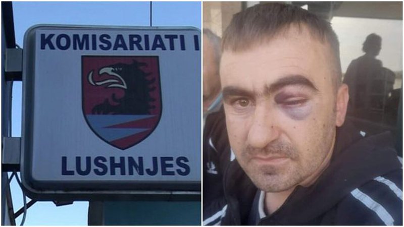 SHÇBA pezullon Inspektorin e Policisë 800 0 617ac92d19ad7