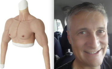 Shkon me krah silikoni që të bëjë vaksinën, kapet mat dentisti! Guido Russo i