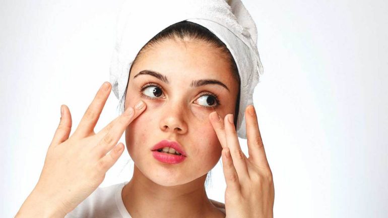 Pesë këshilla të vlefshme për të mbrojtur lëkurën e thatë në dimër 1296x728 Dry Skin Under Eyes HEADER 770x432 1