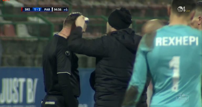 Tifozët e Skënderbeut i çajnë kokën gjyqtarit anësor (Video) can 770x410 1