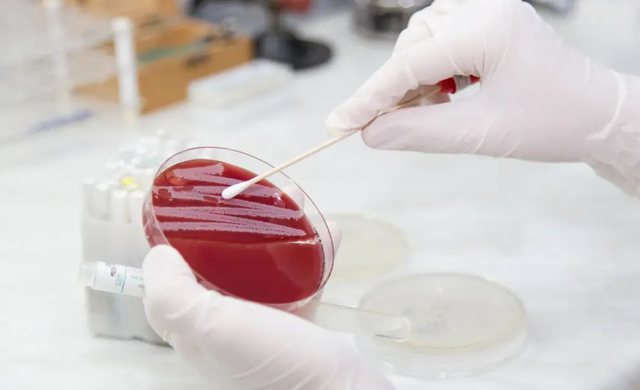 Miliona jetë mund të shpëtohen: Shkencëtarët zbulojnë një antibiotik që anashkalon rezistencën ndaj ilaçeve gjak