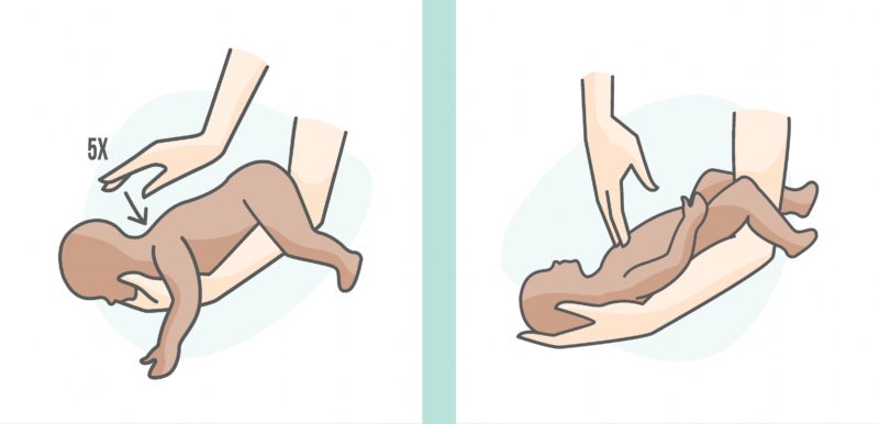 Si të shpëtoni një fëmijë nëse po mbytet baby choking e1482253879724