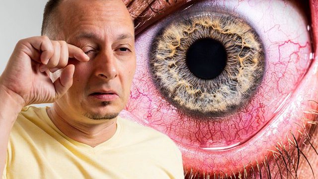 Ju duket se keni diçka në sy, kjo në të vërtetë është shenjë se një sëmundjeje shumë serioze 640 0 631f4d47f2681
