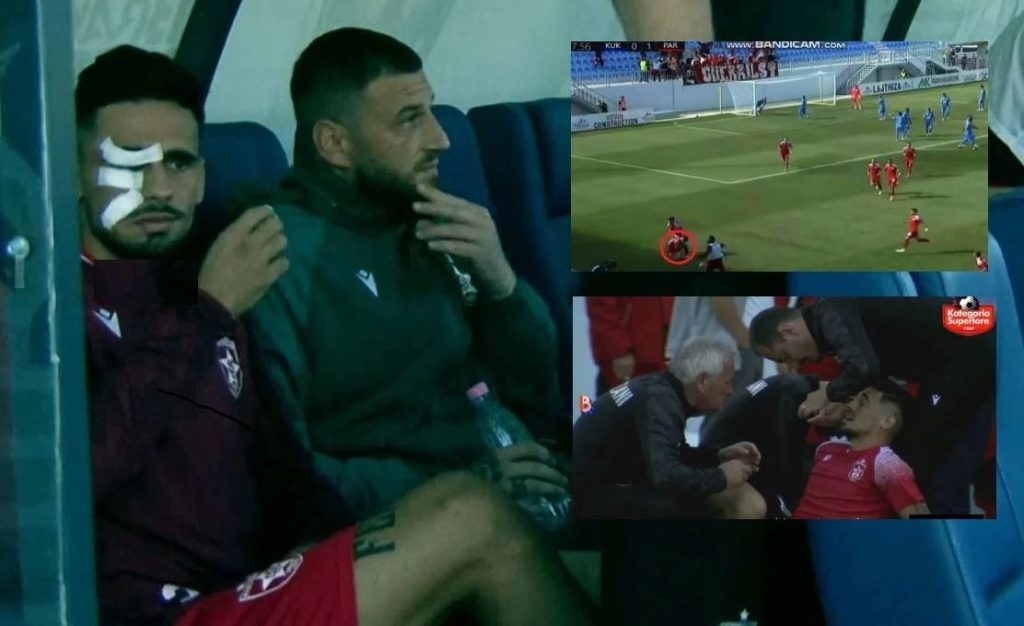 Goditja ndaj Carës, FSHF-ja dënon Kukësin Capture 131
