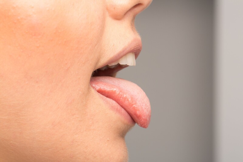 Çfarë do të thotë kur kafshon gjuhën dhe pse nuk është shenjë e mirë? kandida 1