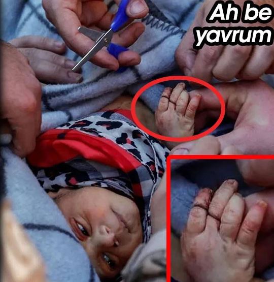 FOTO/ Pas 60 orësh, foshnja 20-ditëshe del nga rrënojat. Në duar mjekët i gjetën flokë të nënës 1 Capture 49