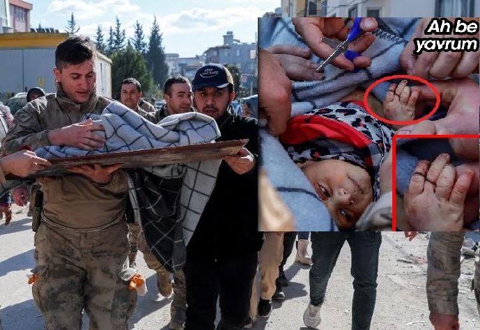 FOTO/ Pas 60 orësh, foshnja 20-ditëshe del nga rrënojat. Në duar mjekët i gjetën flokë të nënës foshnja 1 e1675946171920