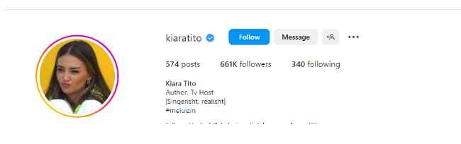 Kiara surprizon ndjekësit, ndryshimi që bëri në "Instagram" 1 hy
