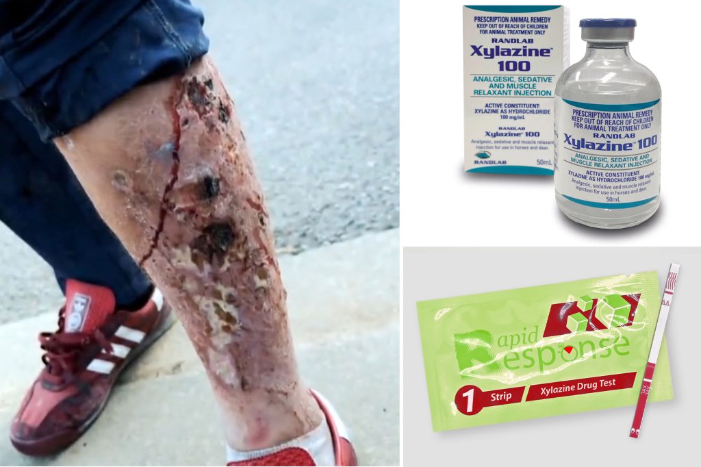 Droga që kthen përdoruesit në “zombi”, mbërrin në Europë xylazine comp
