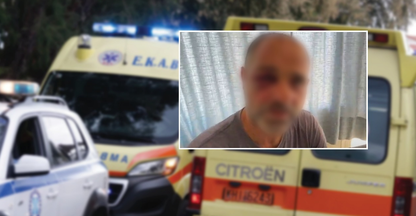 Babë e bir me origjinë shqiptare rrahin me bastun grekun në mes të rrugës 1212