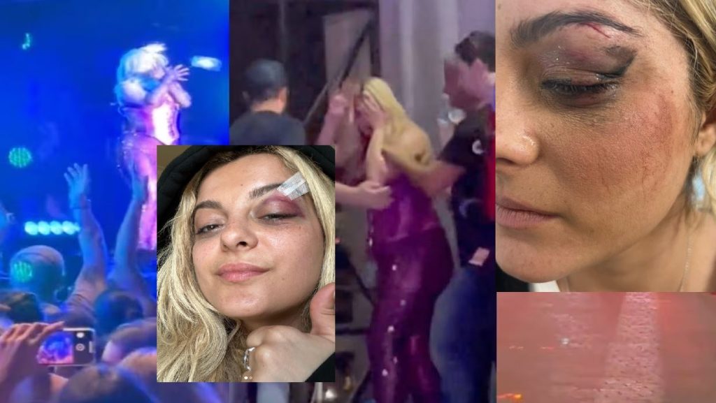 Goditi me telefon Bebe Rexhën, agresori tregon pse e bëri rrrr