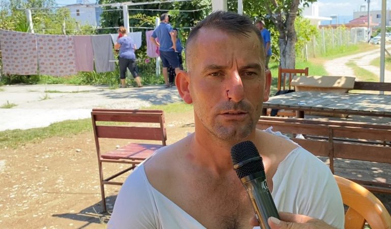 Konflikti në Hamallaj, flet i dhunuari: Na qëlluan me shkopa bejsbolli kaci 768x450 1