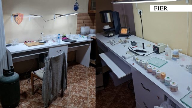 Rrezikoi shëndetin e pacientëve, arestohet 40-vjeçari që hiqej si laborant dentar në Fier 640 0 5ec762a7bcd9b67fa0f1459e2f2dc593