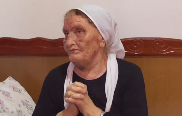 “Njëri më goditi nga pas, e kafshova dhe më lëshoi”, 81-vjeçarja tregon si u dhunua nga hajdutët Rahime Dardha