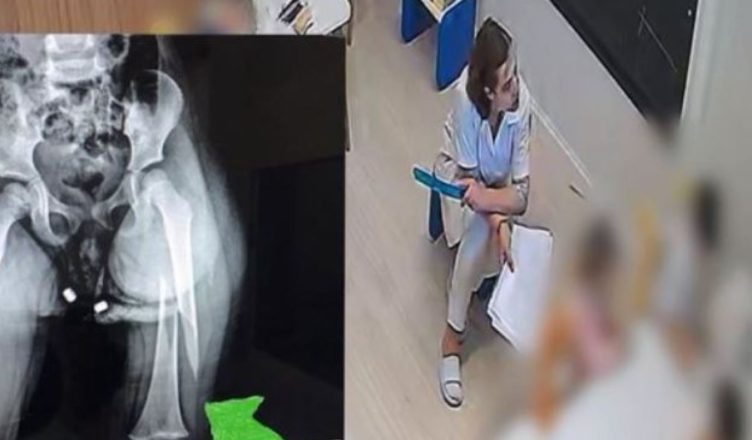 Dhunimi i 3-vjeçares, AMP çon në prokurori dy punonjës policie Dhuna ne kopsht