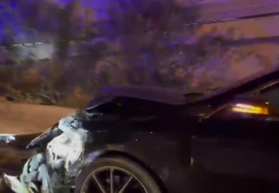 Aksident pranë Kopshtit Zoologjik në Tiranë, raportohet për një person të plagosur IMG 6189
