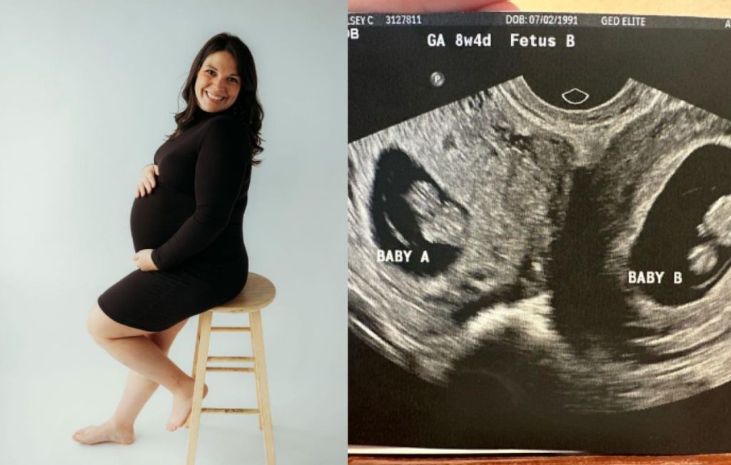 FOTO/ Gruaja me dy mitra është shtatzënë në të dyja, ndodh 1 në 50 milion kelsey hatcher mujer embarazada uteros 1