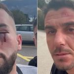 Dhunimi i 3 shqiptarëve në Malin e Zi, policia: Janë identifikuar 3 autorët, sherri nisi pas një debati në trafik 1 1704570250 cccc transformed