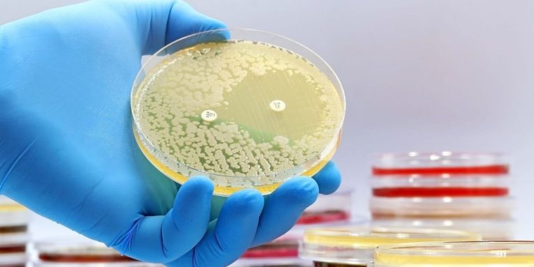 Shkencëtarët zbulojnë antibiotikët e parë të rinj në mbi 60 vjet duke përdorur inteligjencën artificiale antibiotik ilac shkence 765x383 1