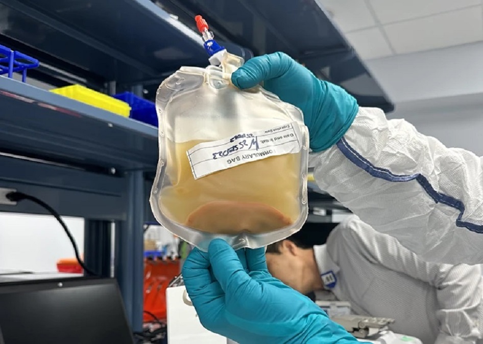 Trajtimi eksperimental, “mini mëlçitë” që mund të shpëtojnë pacientët në nevojë për një transplant melcite