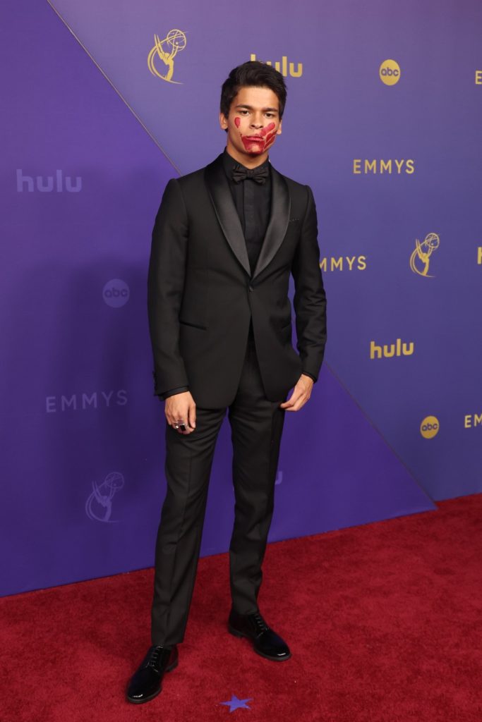 FOTO/ Me një shenjë të kuqe në fytyrë, aktori kanadez merr vëmendjen në "Emmy Awards". Ja kuptimi 1 s1