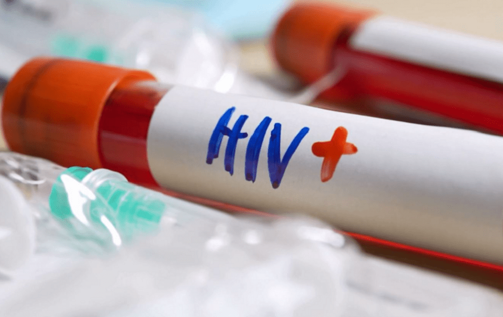 HIV në Shqipëri, mbaron fondi global, të prekurit nuk kanë kondom hiv