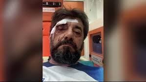Dhunohet Ilir Demalia, analisti: Sulmi nuk lidhet me motive politike images 6